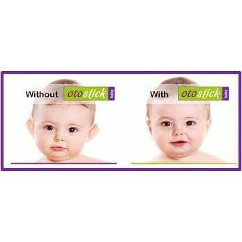 Otostick Australia Baby Infant Ear Tape Ear Correctors with Head Cap - Little Kids Business